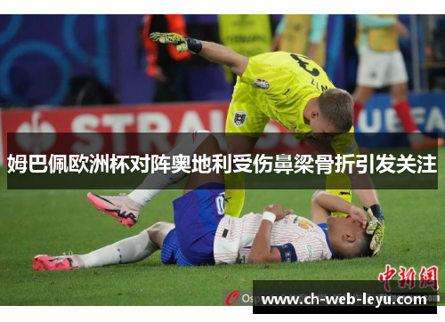 姆巴佩欧洲杯对阵奥地利受伤鼻梁骨折引发关注